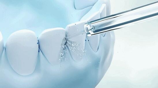 Su Flosser: Ağız Baxımı üçün Müasir Silah